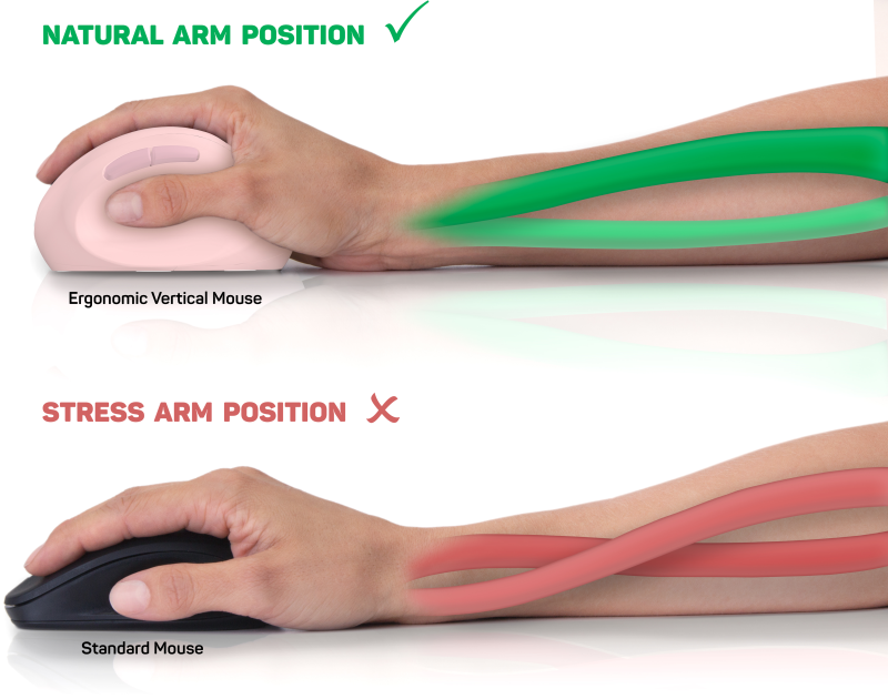 CONNECT IT FOR HEALTH LADIES ergonomická vertikálna myš, bezdrôtová